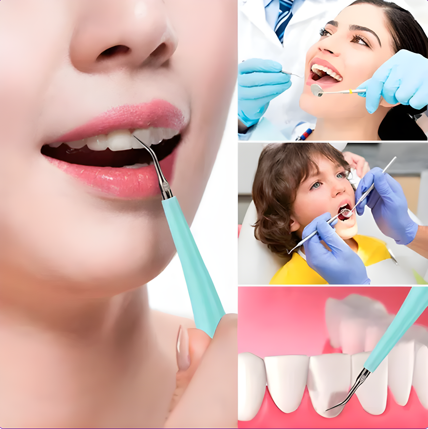Electric® Cleaner l Limpiador Dental