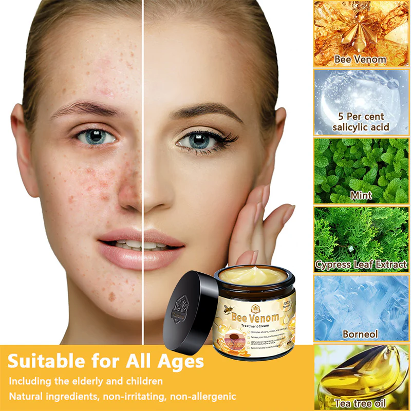 Crema para el tratamiento de la piel con veneno de abeja Turonu™ (aprobada por Health Canada)
