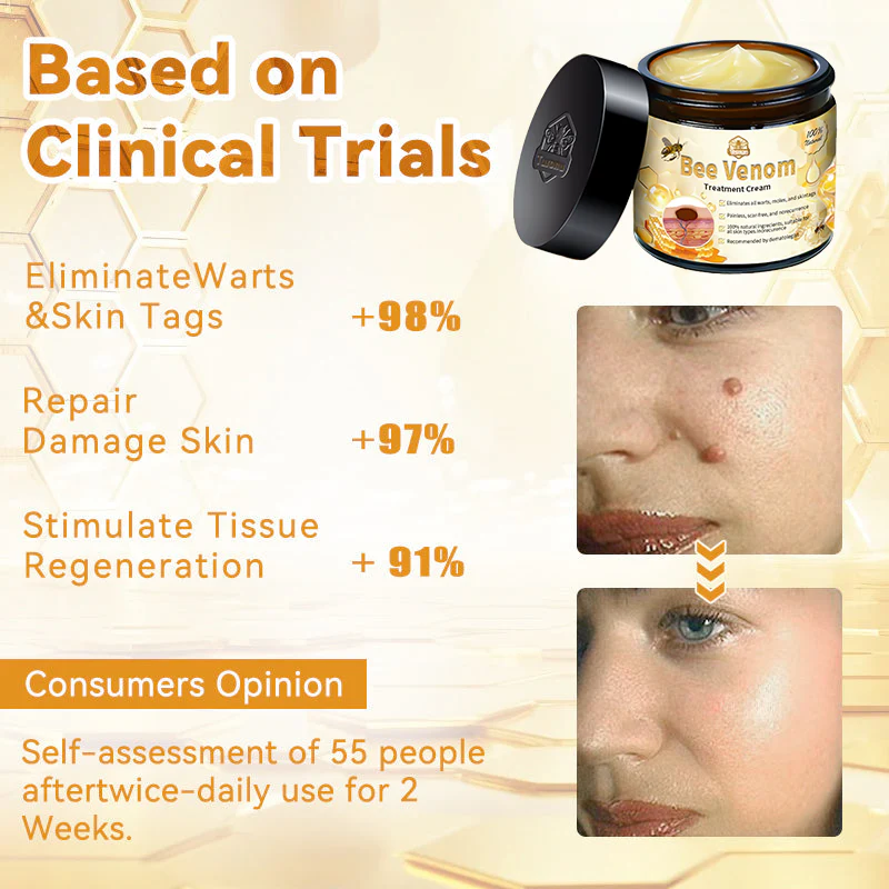 Crema para el tratamiento de la piel con veneno de abeja Turonu™ (aprobada por Health Canada)